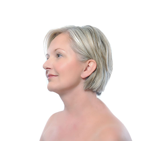 Skin treatment