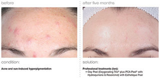 Treatment photo