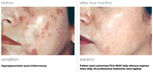 Treatment photo