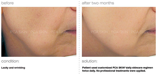 Treatment photo